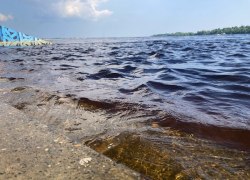 В ХМАО личинки глистов, проникая под кожу, заражают купающихся дерматитом