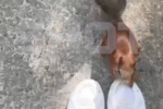 Жительница Сургута будет лечиться три месяца после нападения парковой белки