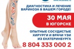 Можно ли вылечить варикоз за 1 день? Да, такое возможно