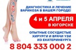Можно ли вылечить варикоз за 1 день? Да, такое возможно