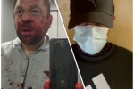 Избивший общественника из Югорска мужчина признал свою вину и записал видеообращение с извинениями. Но примириться так и не удалось